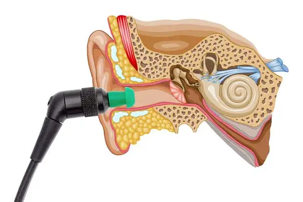 A diagram of how OAE devices work. Put in kid's ear, play sound, if sound play back hearing good!